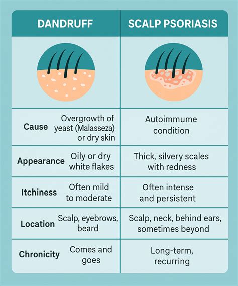 Visual comparison of different scalp conditions like psoriasis, folliculitis, and dandruff.