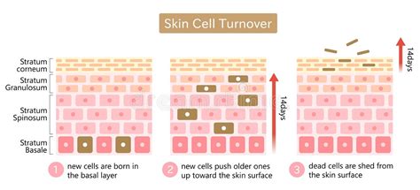 Illustration showing the formation of psoriatic plaques on the skin, highlighting rapid cell turnover and inflammation.