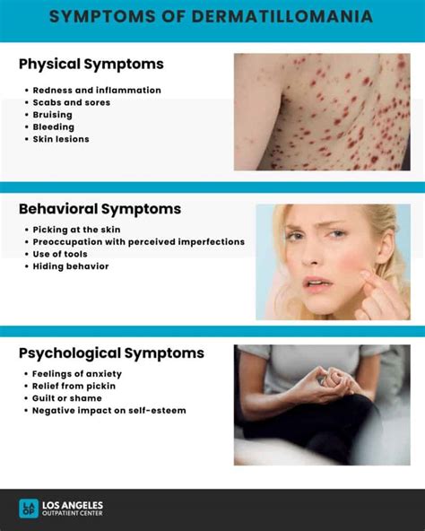 An infographic illustrating the multifactorial causes of skin picking disorder, including genetic, biological, and psychological influences.