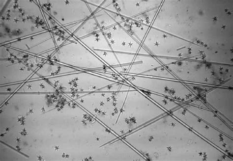 close-up image of spicules under a microscope