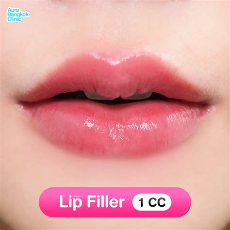 Close-up illustration of a needle injecting lip filler into the Cupid's bow area of the upper lip.