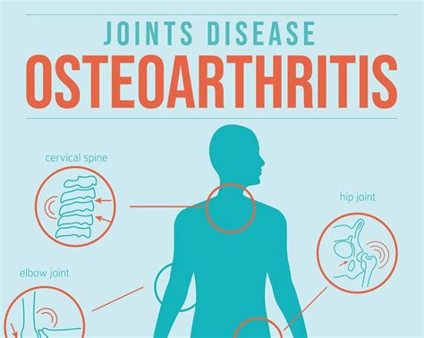 Infographic showing common joints affected by osteoarthritis and potential relief from topical comfrey