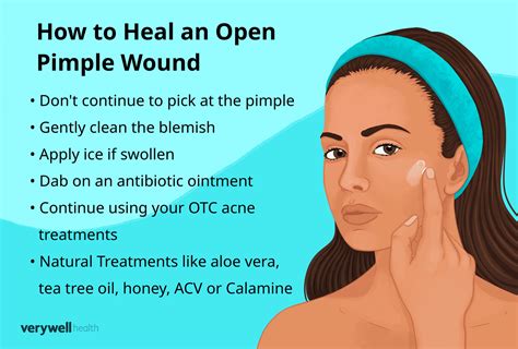 Infographic comparing the healing timeline of a pimple with and without a patch.