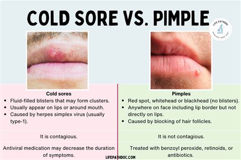 Side-by-side comparison infographic of cold sore vs. pimple symptoms, causes, and appearance.