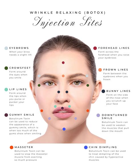 Infographic showing different areas of the face and neck treated with Botox