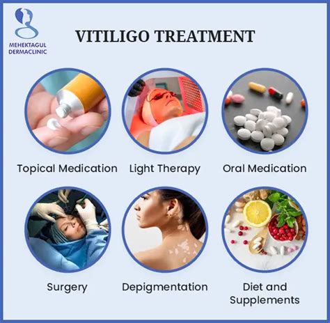 Infographic comparing different treatment options for vitiligo, including their efficacy and potential side effects.