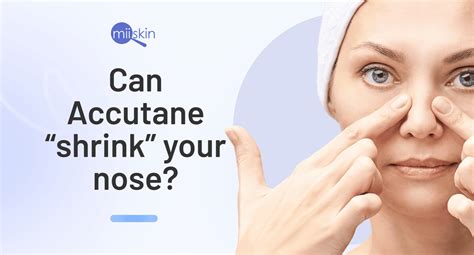 Infographic illustrating how Accutane works on oil glands and pores.