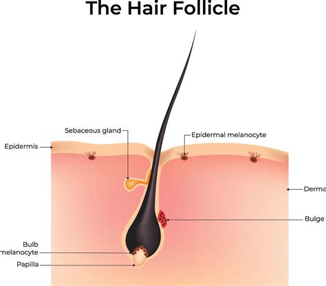 Cross-section of skin illustrating a sebaceous gland associated with a hair follicle, showing the duct opening into the follicle.