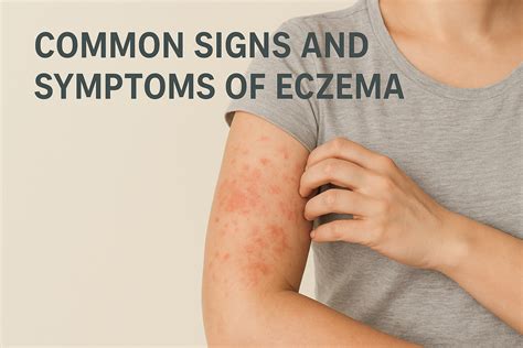 A child's skin showing signs of eczema, with a dermatologist examining it