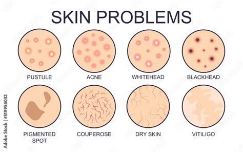 A visual guide to different types of skin conditions, including eczema, psoriasis, and warts