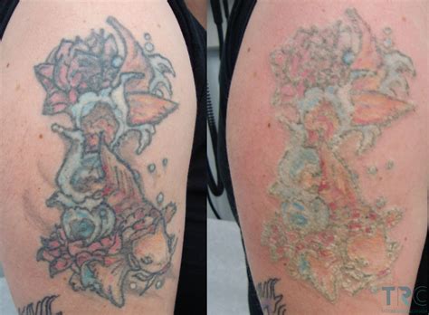 An infographic illustrating areas of the body prone to faster tattoo fading due to friction and movement.