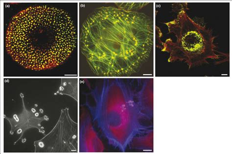 Illustration of melanoma cell spread with key components labeled: podosomes (yellow), cell nuclei (blue), actin (red), and an actin regulator (green).