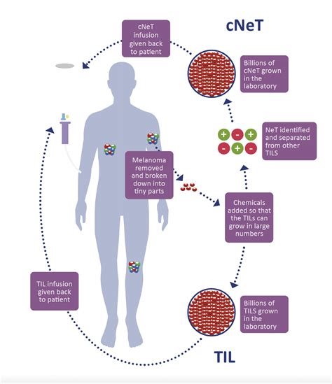 Diagram showing the process of TIL therapy.