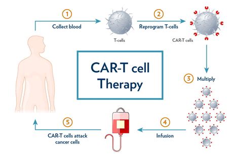 Schematic of how CAR T-cell therapy works.
