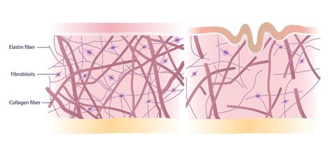 Illustration of collagen fibers in the skin, with peptides and retinoids shown as stimulating agents.