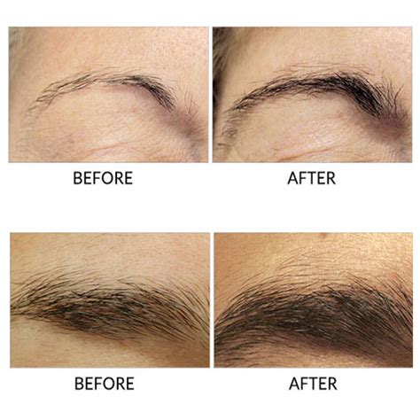 Collage of user-submitted before and after photos of RapidBrow users.