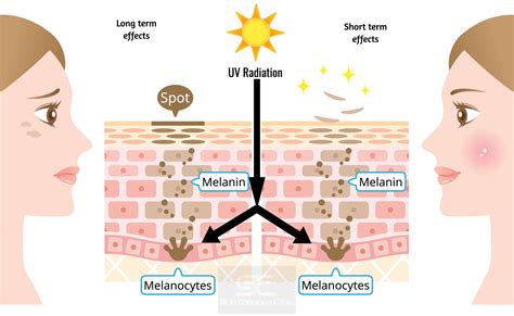 Diagram illustrating how Vitamin C protects skin cells from free radical damage and inhibits melanin production