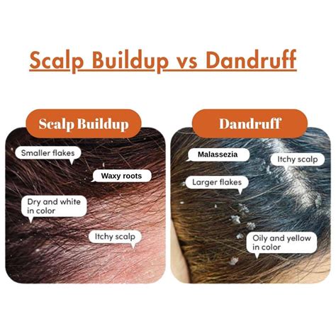Infographic illustrating common causes of scalp buildup