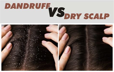 Visual comparison of a clean scalp versus a buildup-affected scalp