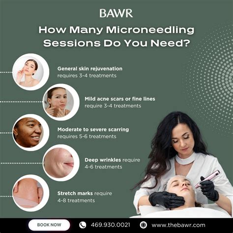 Calendar graphic illustrating the recommended frequency of microneedling sessions