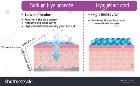 Infographic comparing the molecular structure and penetration capabilities of Hyaluronic Acid and Sodium Hyaluronate.