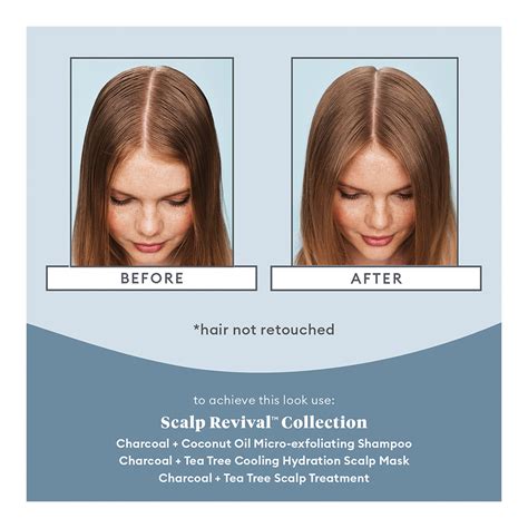Split image showing a before and after of a scalp treated with the Scalp Revival mask, highlighting reduced flaking and improved hydration.