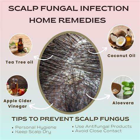 Infographic comparing symptoms and early signs of common scalp fungal infections.