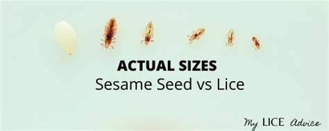 Illustration comparing the size of an adult louse to a sesame seed and a dime.