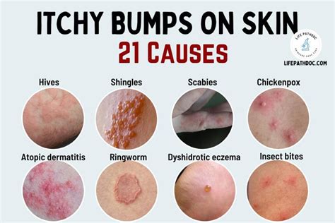 Close-up of skin showing signs of redness, bumps, and excessive oiliness, indicative of over-moisturization.