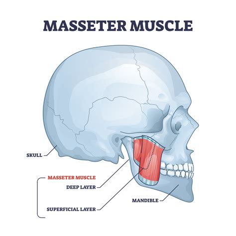 Illustration of the masseter muscle location on the jawline.