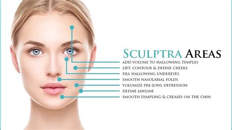 Diagram illustrating facial areas where Sculptra is not recommended