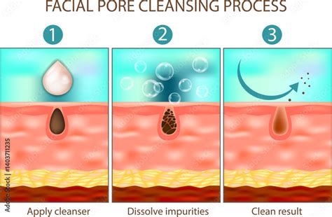 Infographic showing the process of charcoal absorption of impurities from pores