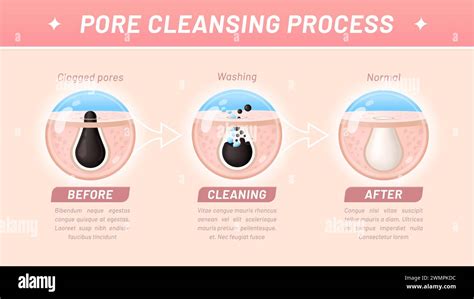 Infographic illustrating the pore-cleansing action of charcoal