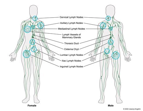 Diagram illustrating the location and appearance of swollen lymph nodes.