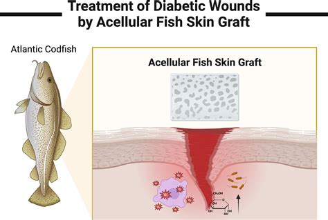 Diagram illustrating the structure of acellular fish skin graft and its components.