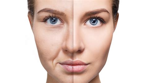 Split image showing a before (dull skin) and after (radiant skin) effect of regular facial cleansing.