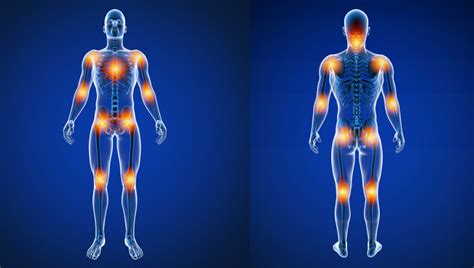 Illustration of common body areas affected by muscle and joint pain, such as the back, shoulders, and knees.