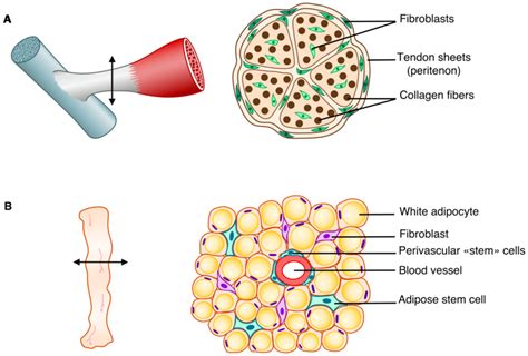 Diagram illustrating the structure of cellulite, showing fat cells pushing up against the skin and fibrous connective tissue pulling down.