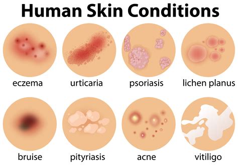 Infographic illustrating different types of pediatric skin conditions and their common symptoms.