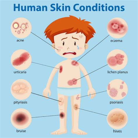 A comparative graphic showing differences in skin conditions between children and adults.