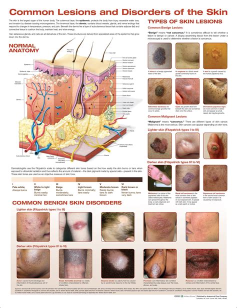 An infographic illustrating common skin conditions and their visual characteristics.