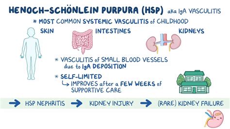 Diagram illustrating intussusception, a potential complication of Henoch-Schonlein purpura.