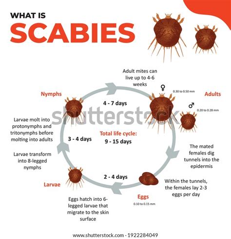 Illustration showing the life cycle of the scabies mite and common locations of scabies rash on the body.