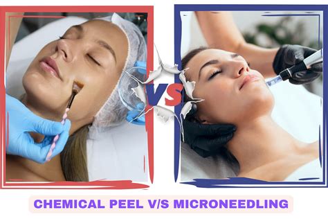 Collage of images representing different facial treatments: a chemical peel application, microneedling pen, dermaplaning tool, and a client receiving an LED light therapy session.