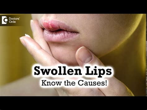 Infographic detailing common causes of swollen lips, categorizing them into allergic reactions, infections, injuries, and medical conditions.