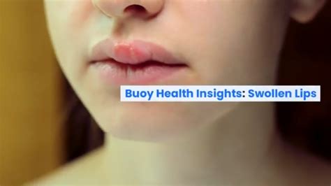 Flowchart guiding users on when to seek medical help for swollen lips, based on symptoms and duration.