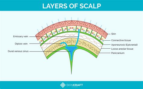 Diagram showing layers of scalp buildup and how exfoliants work