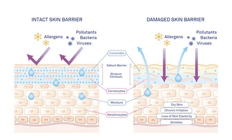 Infographic illustrating the skin barrier function and the effects of dryness.