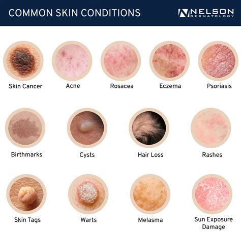 Infographic illustrating common skin conditions treated at the clinic.