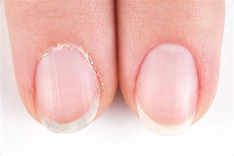 close-up image of healthy, hydrated nails and cuticles